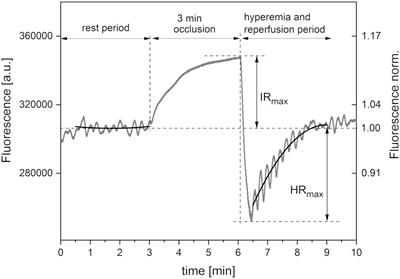 Flowmotion Monitored by Flow Mediated Skin Fluorescence (FMSF): A Tool for Characterization of Microcirculatory Status